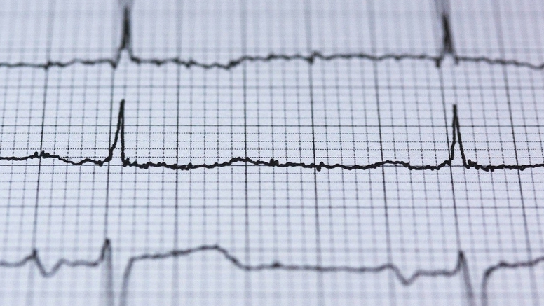 Auszug eines EKG Ausdrucks. (© Pixabay) Auszug eines EKG Ausdrucks.